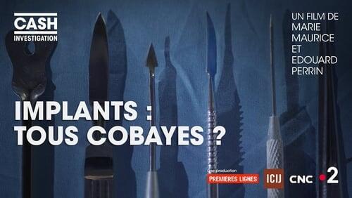 Implants : tous cobayes ?