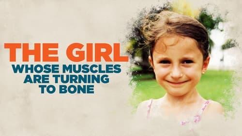 The Girl Whose Muscles are Turning Into Bone