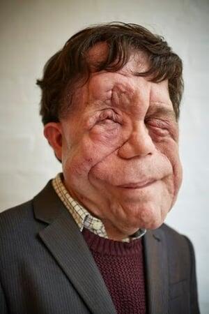 photo of Adam Pearson