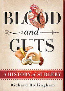 Blood and Guts: A History of Surgery