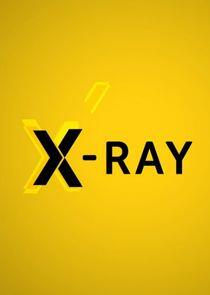 X-Ray