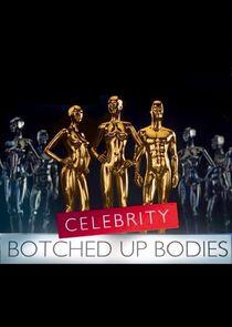 Celebrity Botched Up Bodies